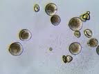 Polline nocciolo al microscopio 1